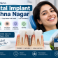 Dental implant in krishna nagar