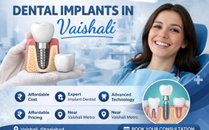dental implant in vaisali
