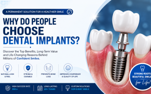 Why Do People Choose Dental Implants