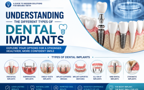 Understanding the Different Types of Dental Implants