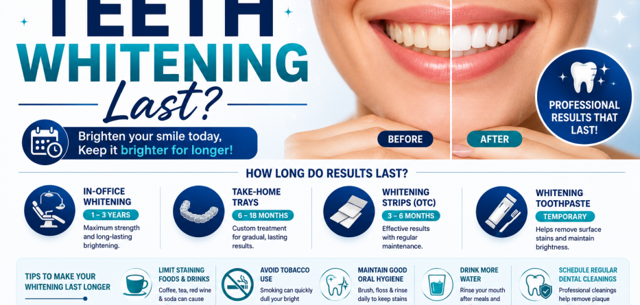 How Long Does Teeth Whitening Last? A Complete Guide