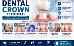 Dental Crown Procedure: Step-by-Step Guide to Restoring Your Smile