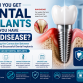 Can You Get Dental Implants If You Have Gum Disease?