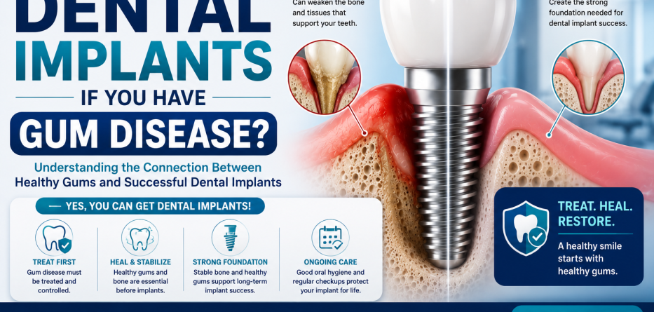 Can You Get Dental Implants If You Have Gum Disease?