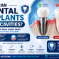 Can Dental Implants Get Cavities? Everything You Need to Know