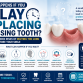 What Happens If You Delay Replacing a Missing Tooth?