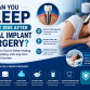 Can You Sleep on the Side After Dental Implant Surgery?