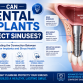 Can Dental Implants Affect Sinuses? Understanding the Connection