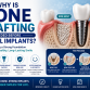 Why Is Bone Grafting Needed Before Dental Implants?