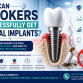 Can Smokers Successfully Get Dental Implants?