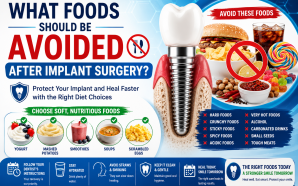 What Foods Should Be Avoided After Implant Surgery?
