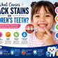 What Causes Black Stains on Children's Teeth?