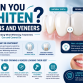Can You Whiten Crowns and Veneers? Everything You Need to Know