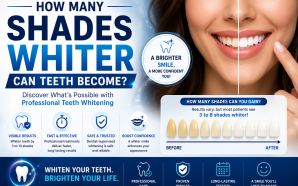 How Many Shades Whiter Can Teeth Become?