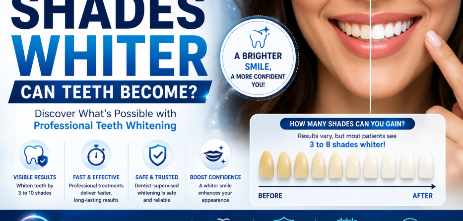 How Many Shades Whiter Can Teeth Become?