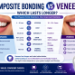 Composite Bonding vs. Veneers: Which Lasts Longer?