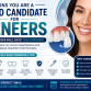 Signs You Are a Good Candidate for Veneers