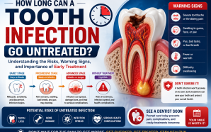 How Long Can a Tooth Infection Go Untreated?