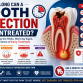 How Long Can a Tooth Infection Go Untreated?