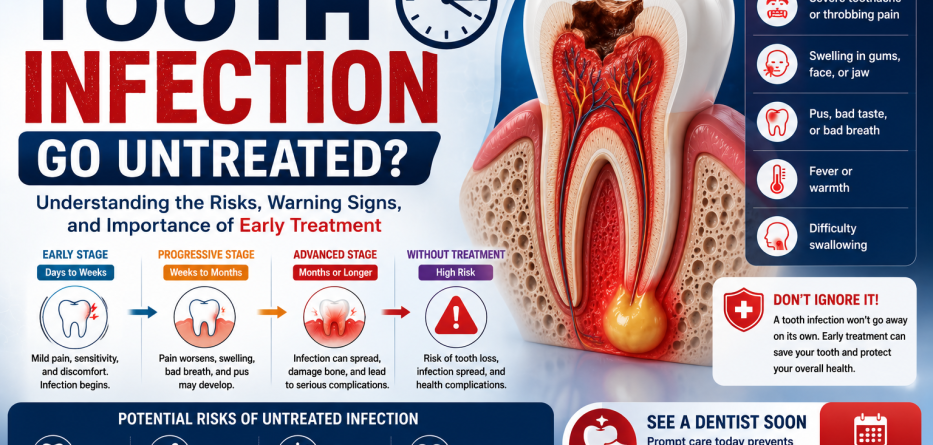 How Long Can a Tooth Infection Go Untreated?