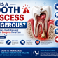 Is a Tooth Abscess Dangerous? Signs, Risks, and Treatment Options
