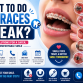 What to Do If Braces Break? A Complete Emergency Guide