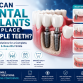 How Can Dental Implants Replace Multiple Teeth?