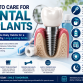 How to Care for Dental Implants: A Complete Guide for Long-Term Success