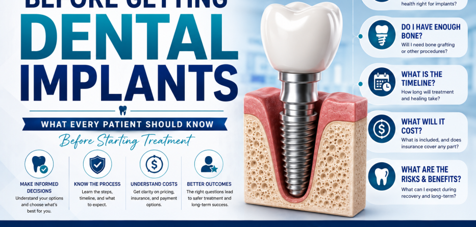 Questions to Ask Before Getting Dental Implants