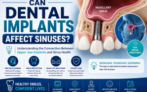 Can Dental Implants Affect Sinuses? Understanding the Connection