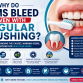 Why Do Gums Bleed Even with Regular Brushing?