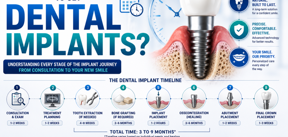 How Long Does It Take to Get Dental Implants?