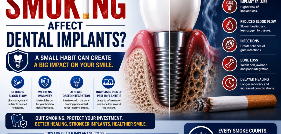 How Does Smoking Affect Dental Implants? A Complete Guide