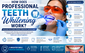 How Does Professional Teeth Whitening Work? A Complete Guide
