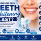 How Long Does Teeth Whitening Last? A Complete Guide