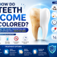 How Do Teeth Become Discolored? Causes, Prevention, and Treatment Options
