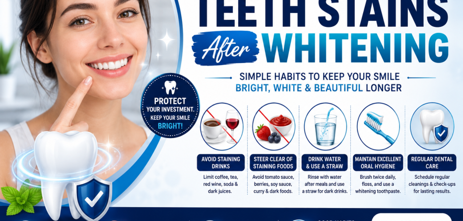 How to Avoid Teeth Stains After Whitening: for Long-Lasting Results