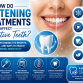 How Do Whitening Treatments Affect Sensitive Teeth?