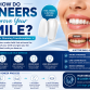 How Do Veneers Improve Your Smile?
