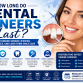 How Long Do Dental Veneers Last? Lifespan, Care Tips, and What to Expect