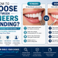 How to Choose Between Veneers and Bonding? A Complete Smile Makeover Guide