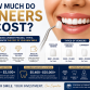 How Much Do Veneers Cost? A Complete Guide to Pricing, Types, and Factors