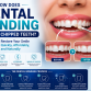 How Does Dental Bonding Repair Chipped Teeth?