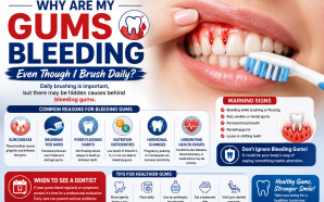 Why Are My Gums Bleeding Even Though I Brush Daily?