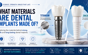 What Materials Are Dental Implants Made Of? A Complete Guide