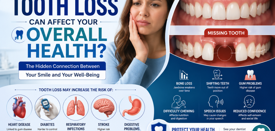 How Can Tooth Loss Affect Your Overall Health?