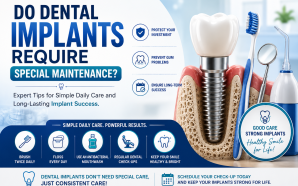 Do Dental Implants Require Special Maintenance?