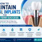 How to Maintain Dental Implants for Long-Term Success